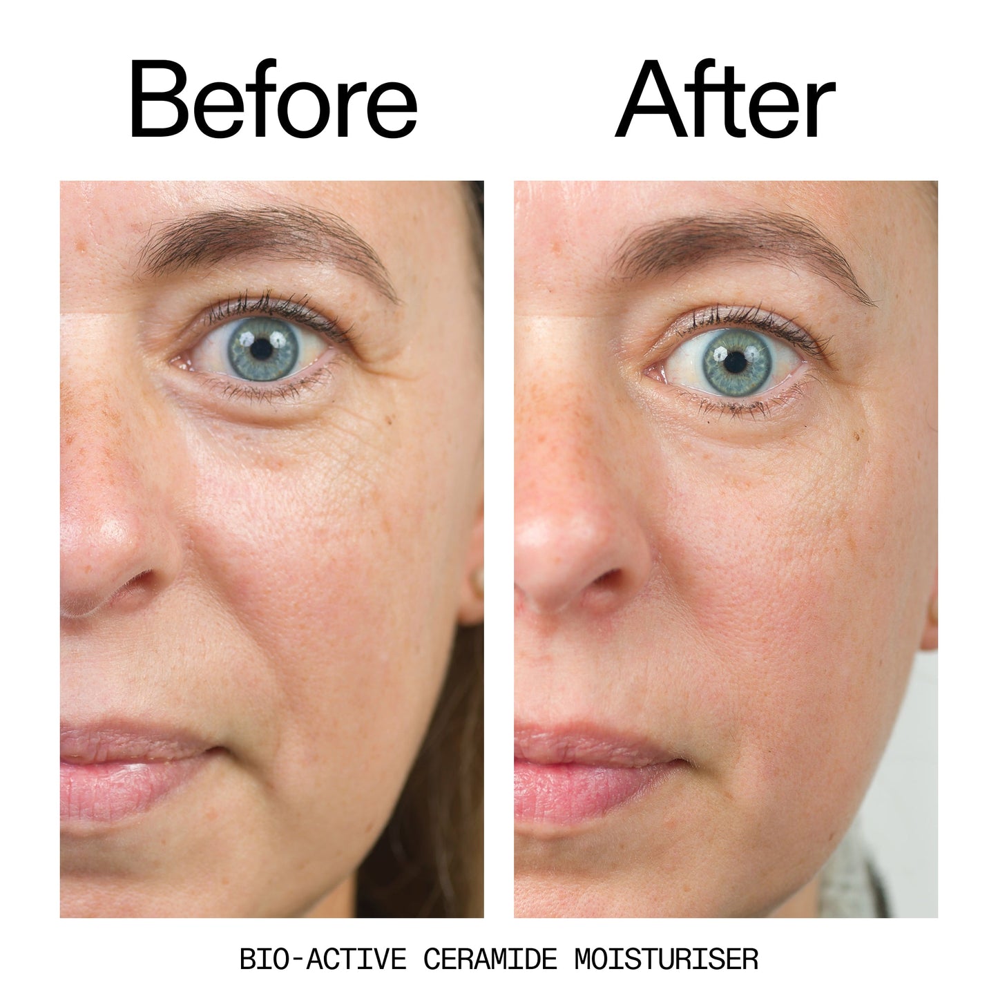 barrier-boosting-trio-p3 Bio-Active_Before_After_2000x2000_600947b4-e8c5-425a-9155-fc15bc83aa12.jpg