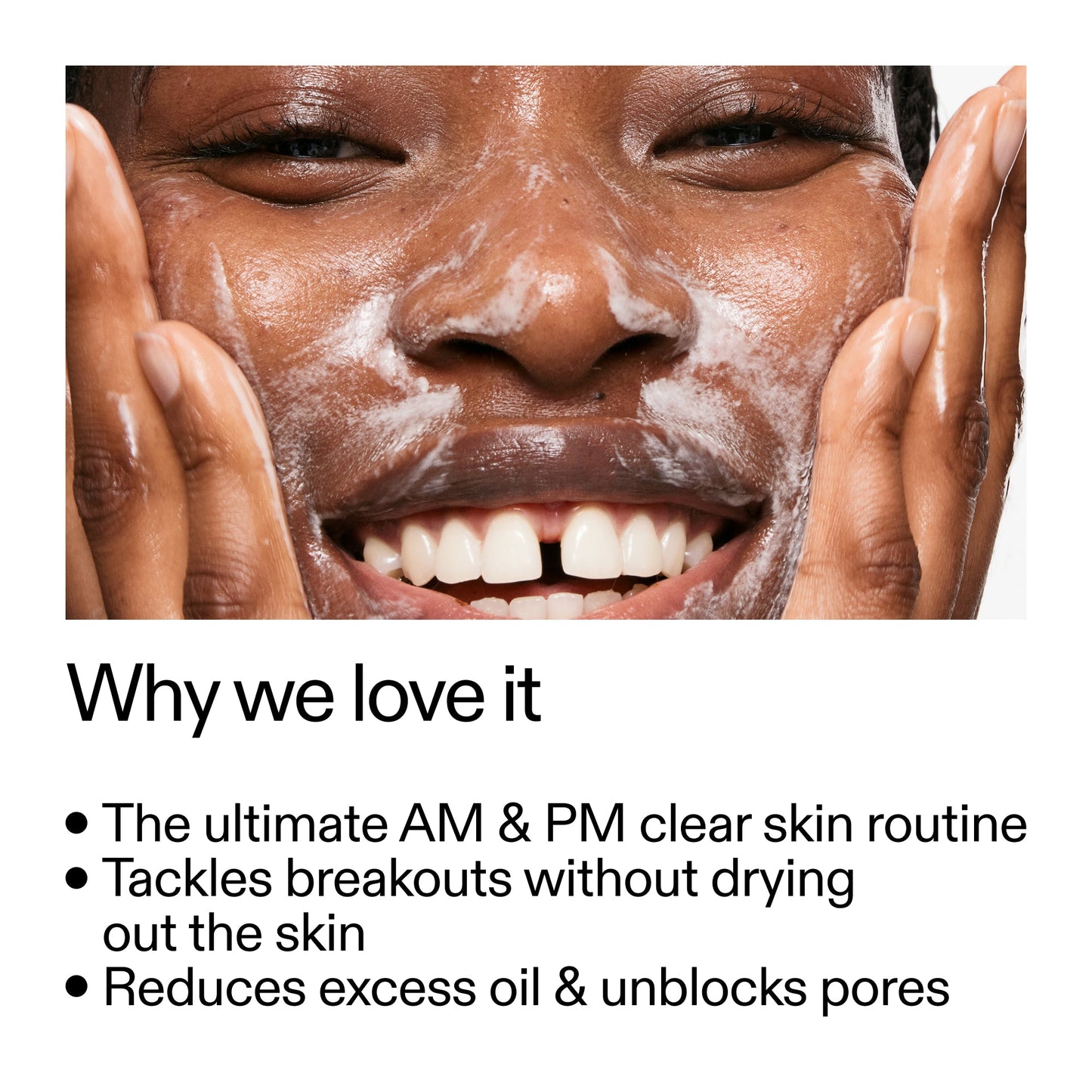 intro-routine-for-acne-a2 Intro_Routine_for_Acne_Why_we_love_it_2000x2000_42499e10-4629-4a0e-a627-7e215f4da6bc.jpg