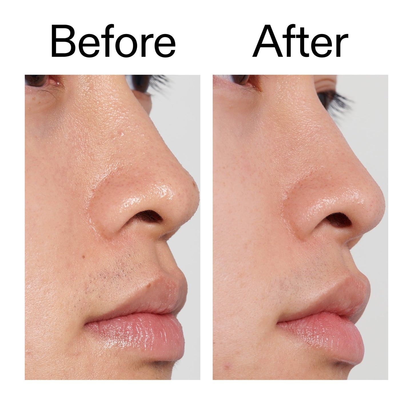 pha-toner-c4 PHA_Toner_Before_After_2000x2000_e3c10172-0150-4342-8b95-57417eaff50d.jpg