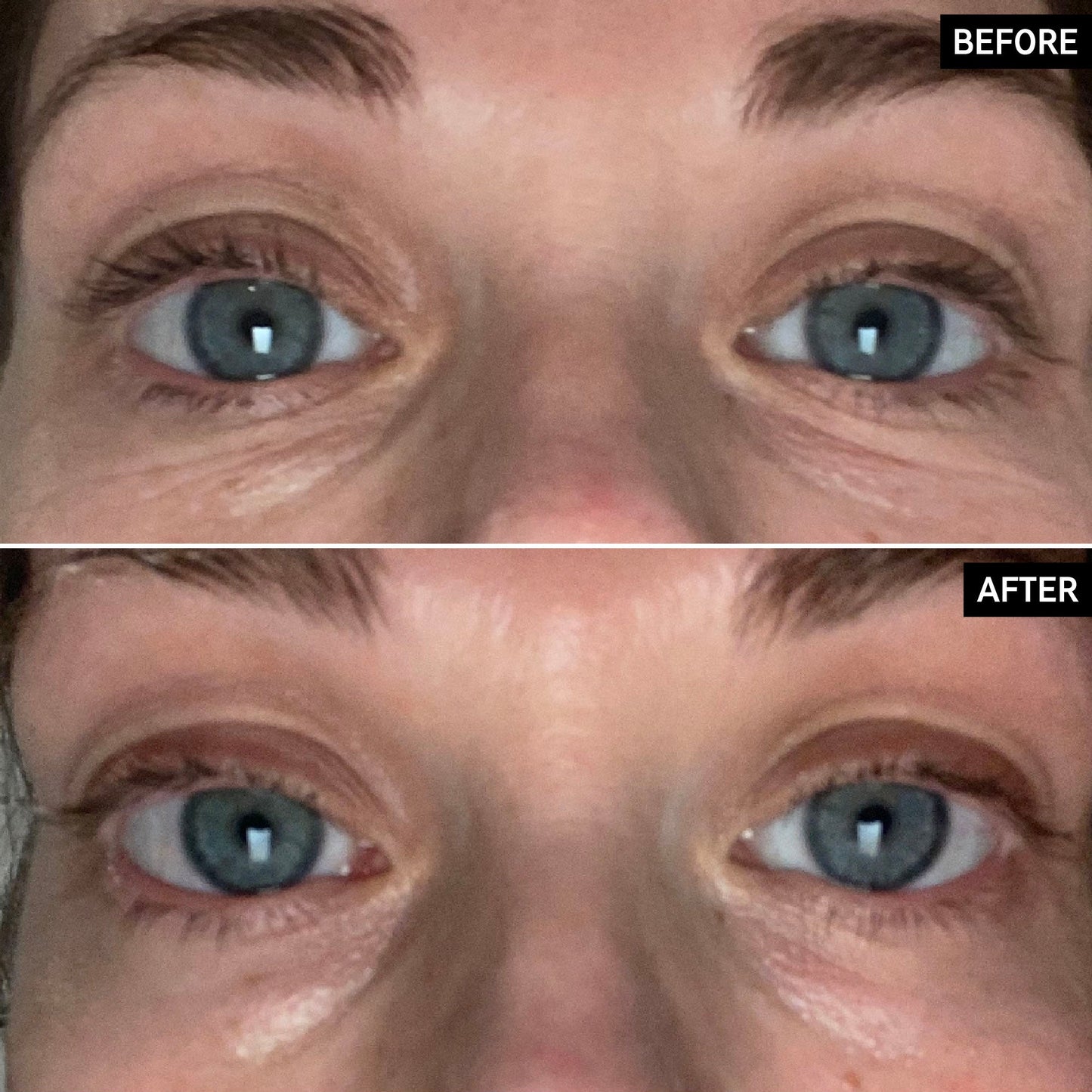retinol-eye-cream-w8 SITE-UGCBAsApril_Nicole_B_A_PPage_2000x2000_1.jpg