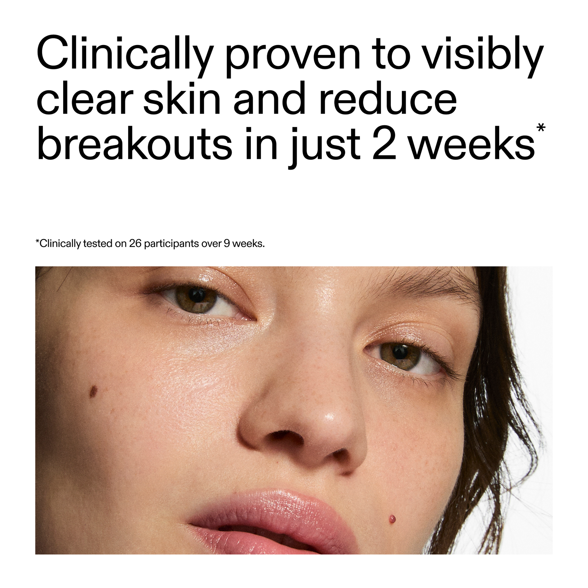 360-acne-clearing-serum-h5 360_Serum_Key_Claim.png