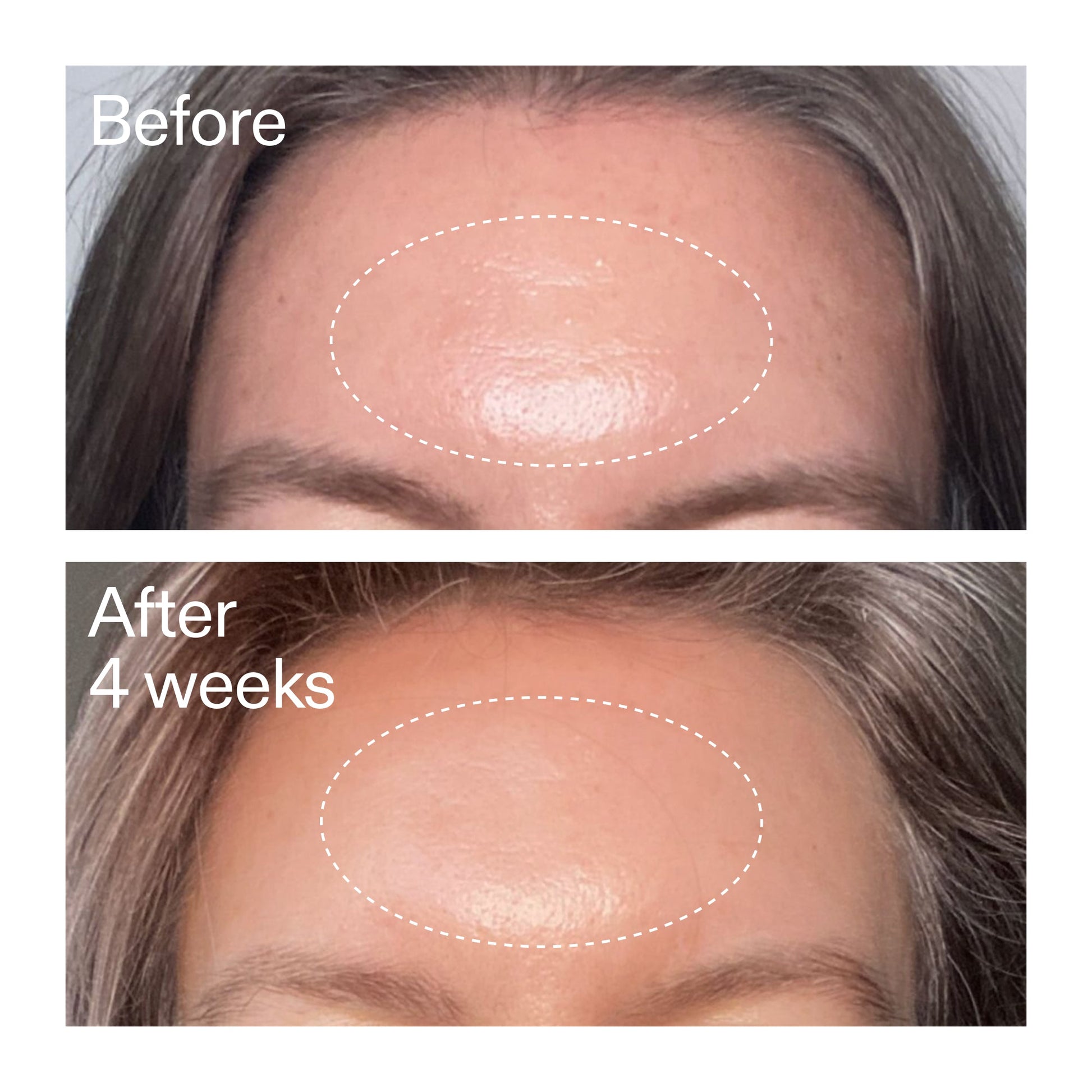 advanced-0-2-retinal-serum-k3 AdvancedRetinal_BeforeAfter1_2000x2000_1da6bb0a-29dd-41d1-95b7-8679696bbf0f.jpg