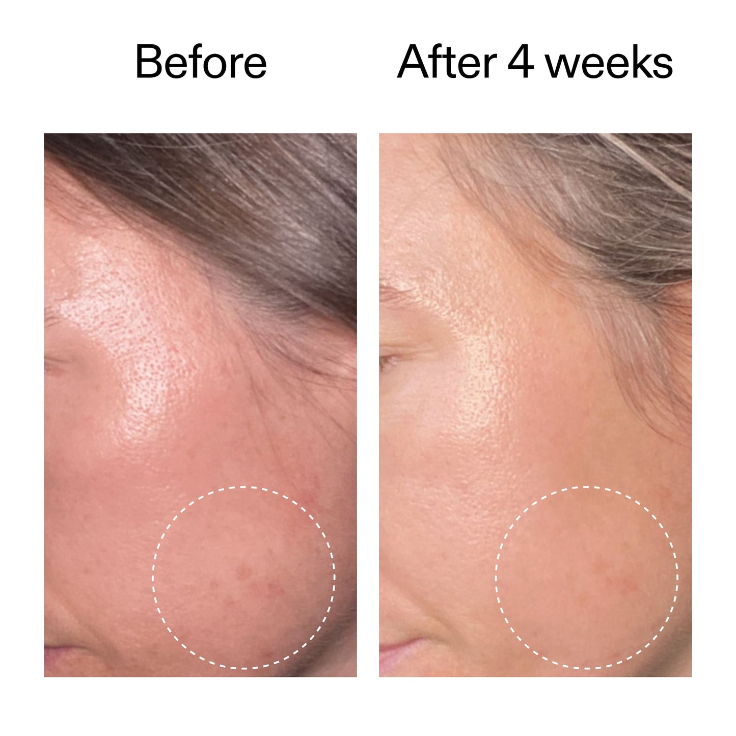 advanced-0-2-retinal-serum-k3 AdvancedRetinal_BeforeAfter2__2000x2000_62fb16bb-77ae-4d63-8500-88dbf847f4b9.jpg