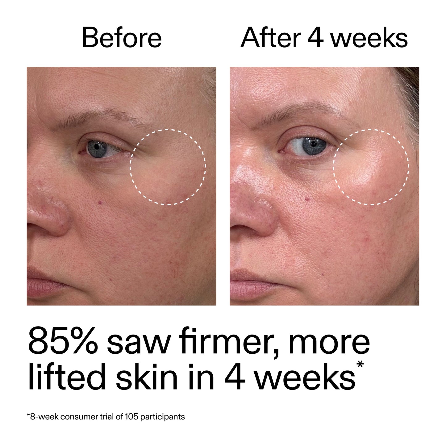 advanced-0-2-retinal-serum-duo-i9 AdvancedRetinal_BeforeAfter_Claim1_2000x2000_3a315aa8-f408-4b33-bbeb-0d9209f98404.jpg