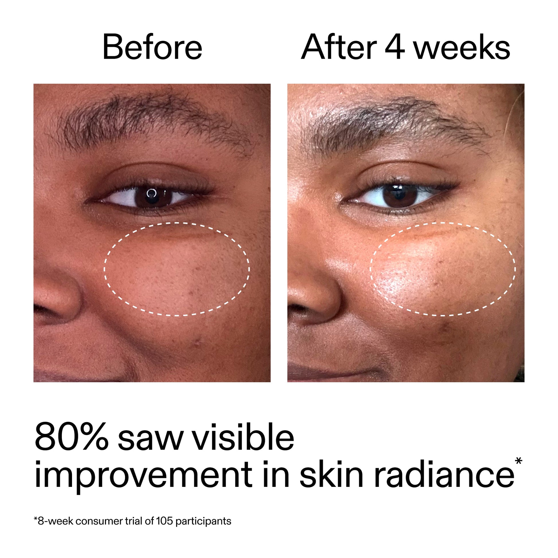 advanced-0-2-retinal-serum-k3 AdvancedRetinal_BeforeAfter_Claim2_2000x2000_39d11e3d-eda9-44ec-ab32-2903b1a368bd.jpg