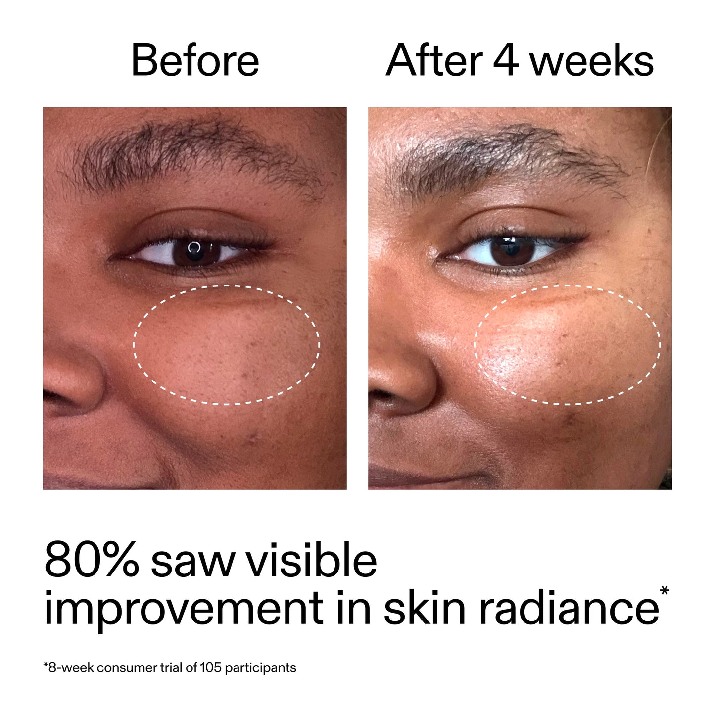 advanced-0-2-retinal-serum-duo-i9 AdvancedRetinal_BeforeAfter_Claim2_2000x2000_681b621d-8d44-4d44-9a40-89244f9b2e53.jpg