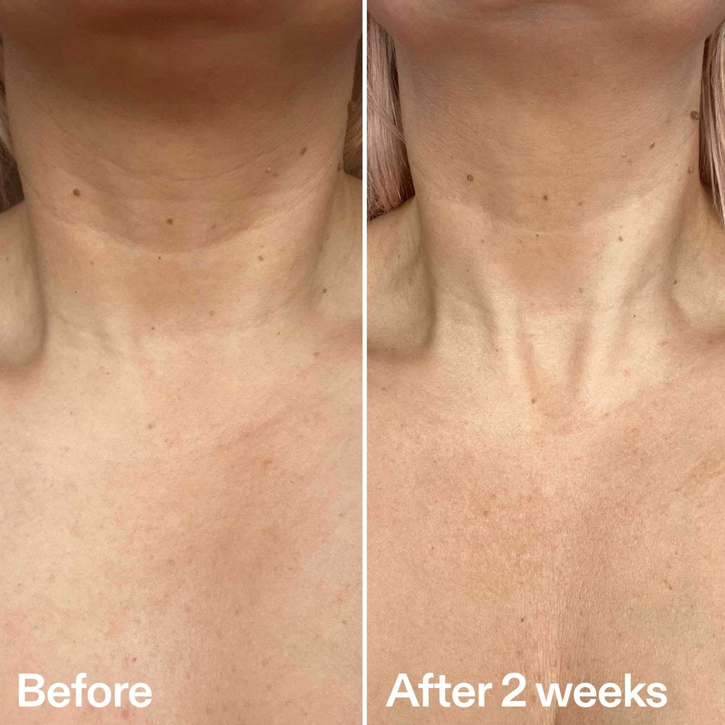 bio-active-neck-lift-stick-r9 B_A_2.jpg