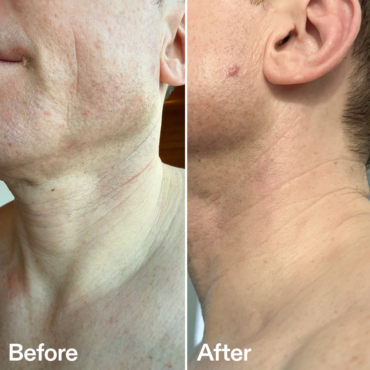 bio-active-neck-lift-stick-r9 B_A_afa2743e-b8e2-4504-92f4-e281cb6cf759.jpg