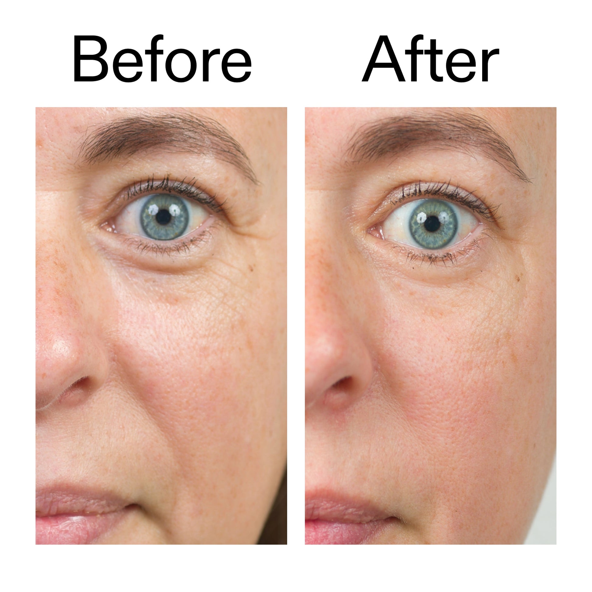 bio-active-ceramide-moisturizer-x4 Bio-Active_Before_After_2000x2000_566e5a9e-135e-417a-8242-b44e5fa35463.jpg