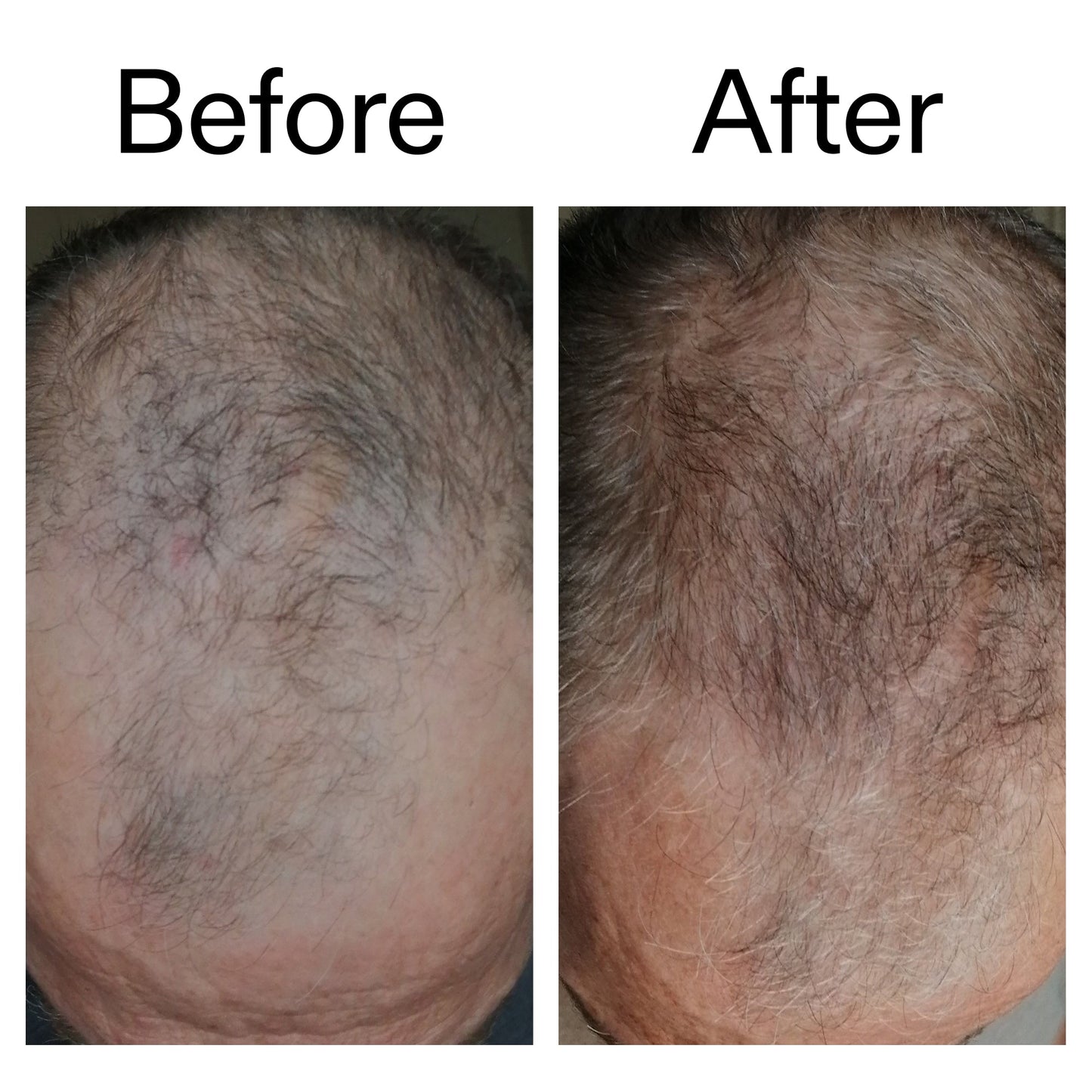 3-month-hair-growth-trio-f3 Caffeine_Scalp_Treatment_B_A_Ppage_2000_x_2000.jpg