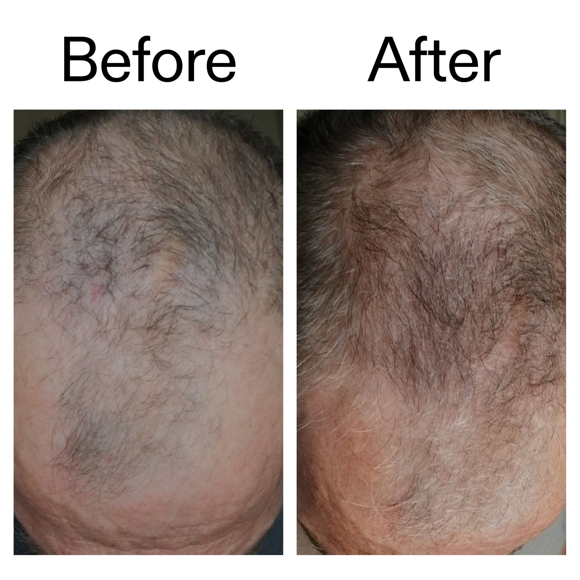 3-month-hair-growth-trio-f3 Caffeine_Scalp_Treatment_B_A_Ppage_2000_x_2000.jpg