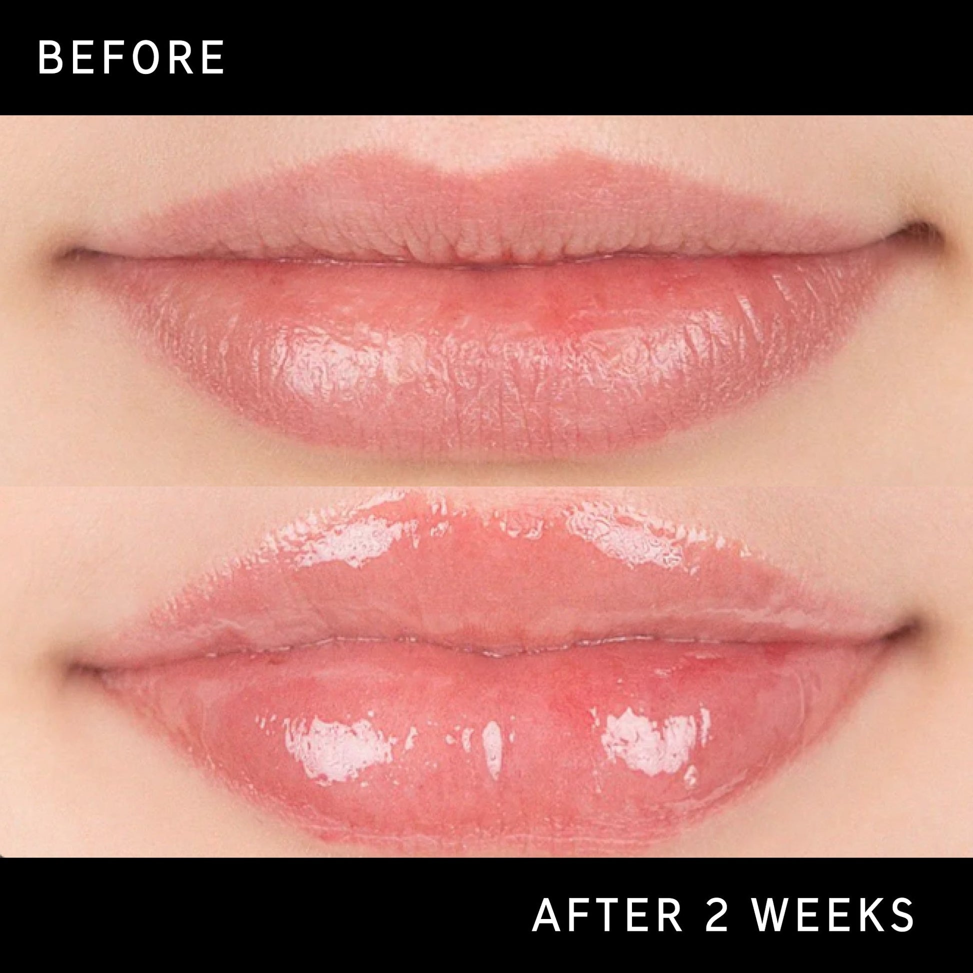 lip-plumping-duo-g6 DTC-Top15_Amends_Tripeptide-Lip_B_A.jpg