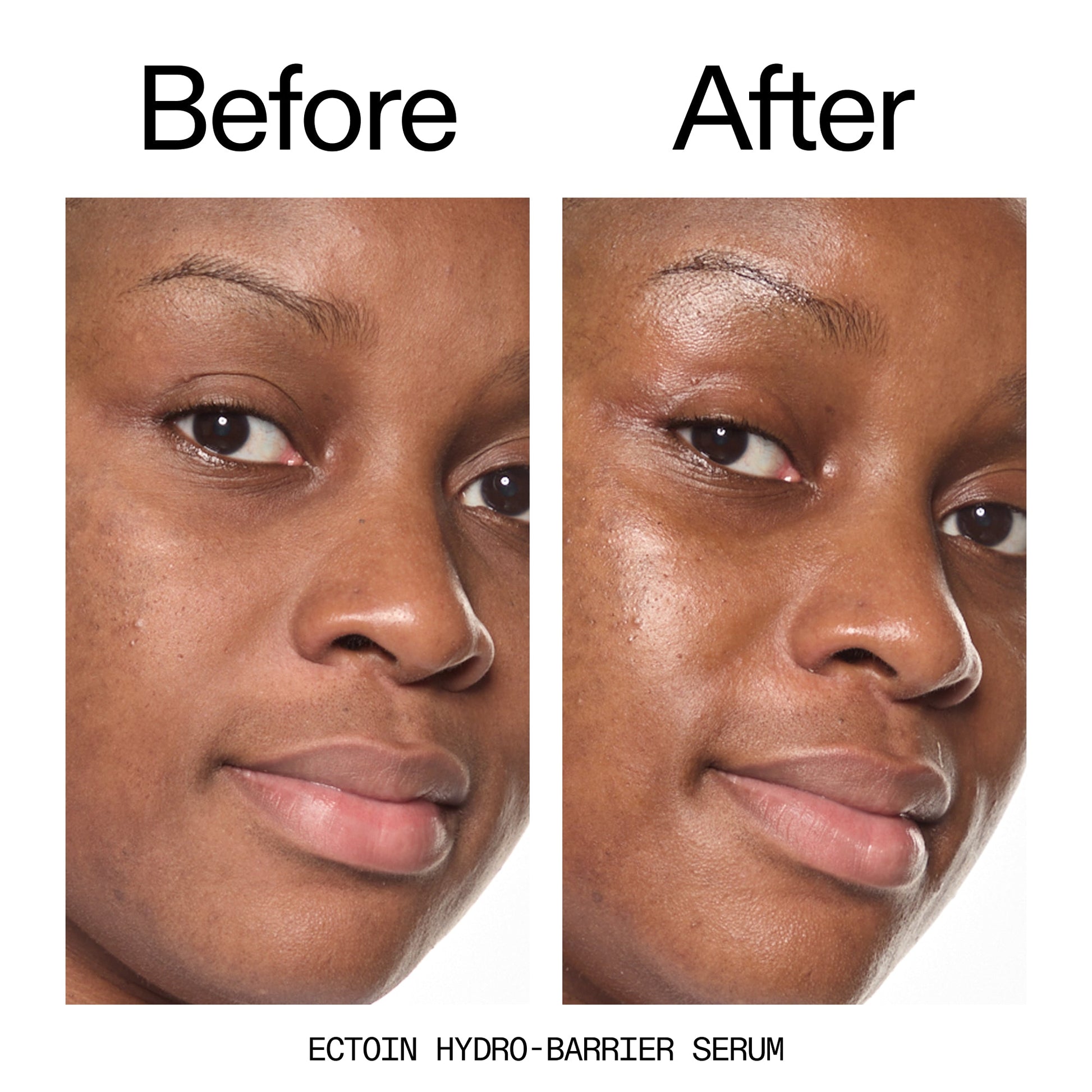 barrier-boosting-trio-p3 Ectoin_Before_After_2000x2000_ce35bc41-4da0-4b6f-adc7-29f8641f6c6c.jpg
