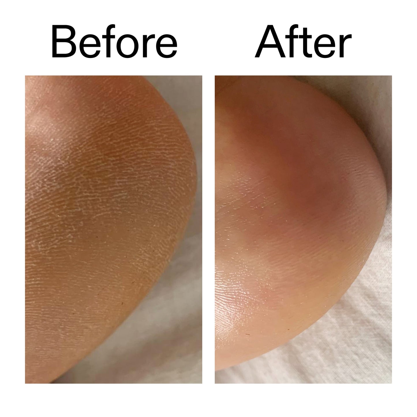 glycolic-acid-exfoliating-body-stick-duo-n5 Glycolic_Acid_Exfoliating_Body_Stick_Before_After_V1_2000x2000_a3043625-9400-429a-a7fb-d6dbd220f722.jpg