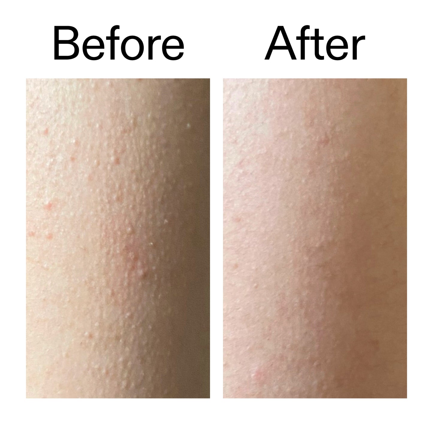 glycolic-acid-exfoliating-body-stick-z2 Glycolic_Acid_Exfoliating_Body_Stick_Before_After_V2_2000x2000_2e4ba052-94f6-4d56-82df-7bdb5b2df7ae.jpg