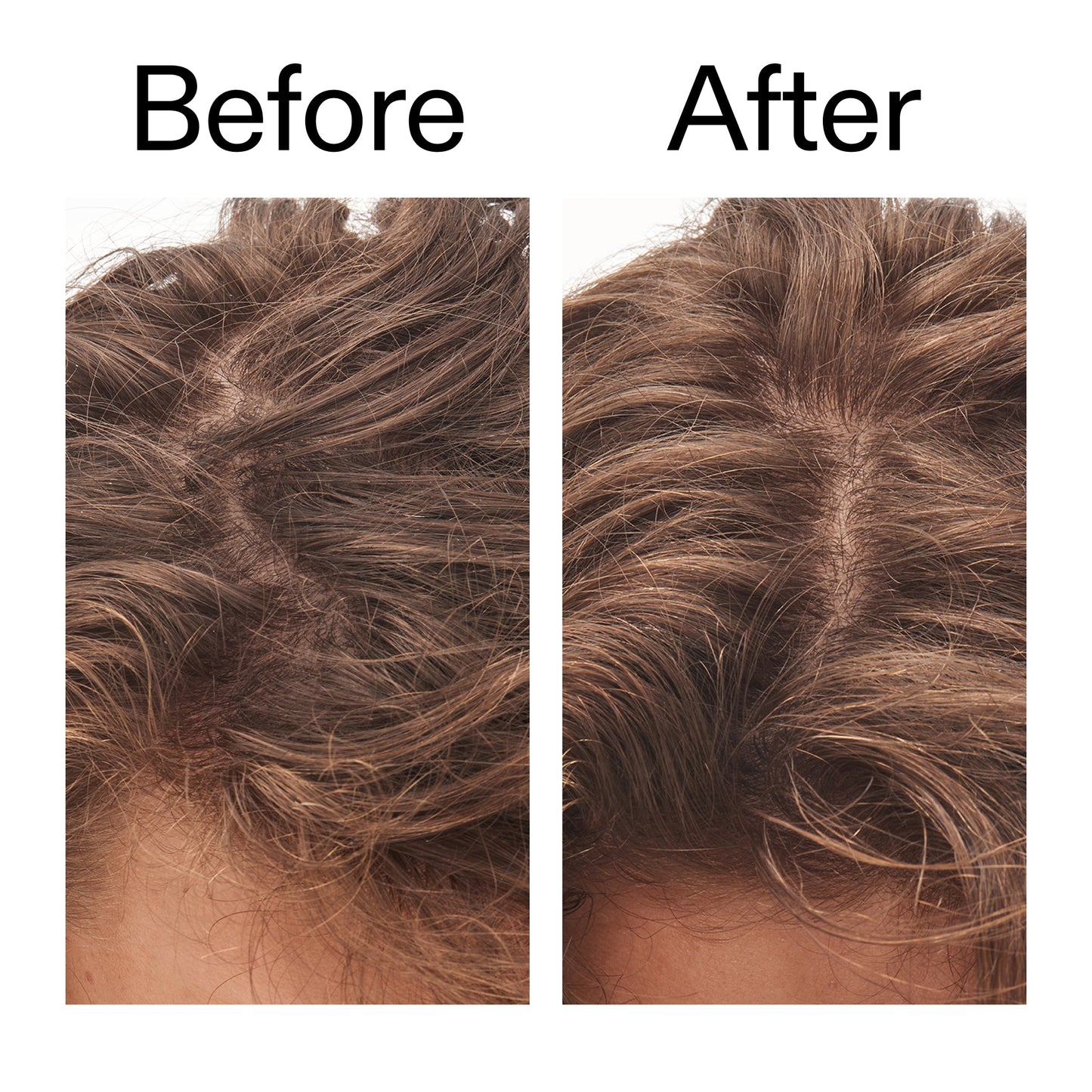 glycolic-acid-exfoliating-scalp-scrub-g6 Glycolic_Acid_Exfoliating_Scalp_Scrub_Before_After_2000x2000_b8561c87-05a1-4caa-80f7-1b6b33d750f7.jpg