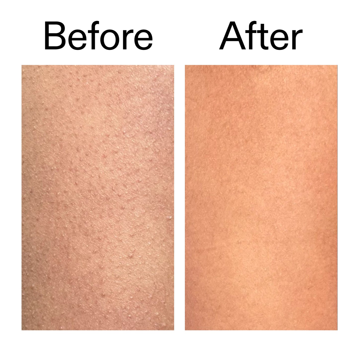 glycolic-acid-exfoliating-body-stick-z2 Glycolic_Body_Stick_B_A_2000x2000_6e6e6b4d-5bd7-43c0-aeed-4d66788e8995.jpg