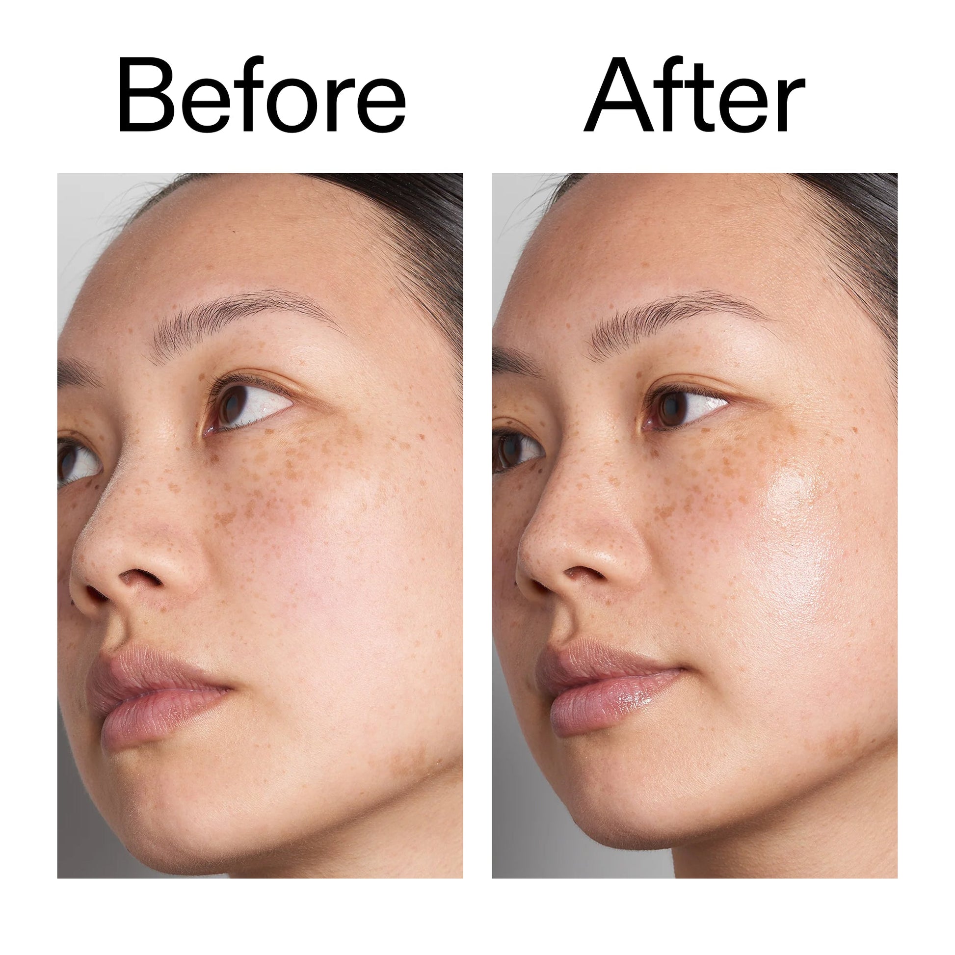 supersize-hyaluronic-acid-serum-100ml-h6 Hyaluronic_Acid_Before_After_2000x2000_d7983956-8aa2-4ea3-8255-c63e8d4f892e.jpg