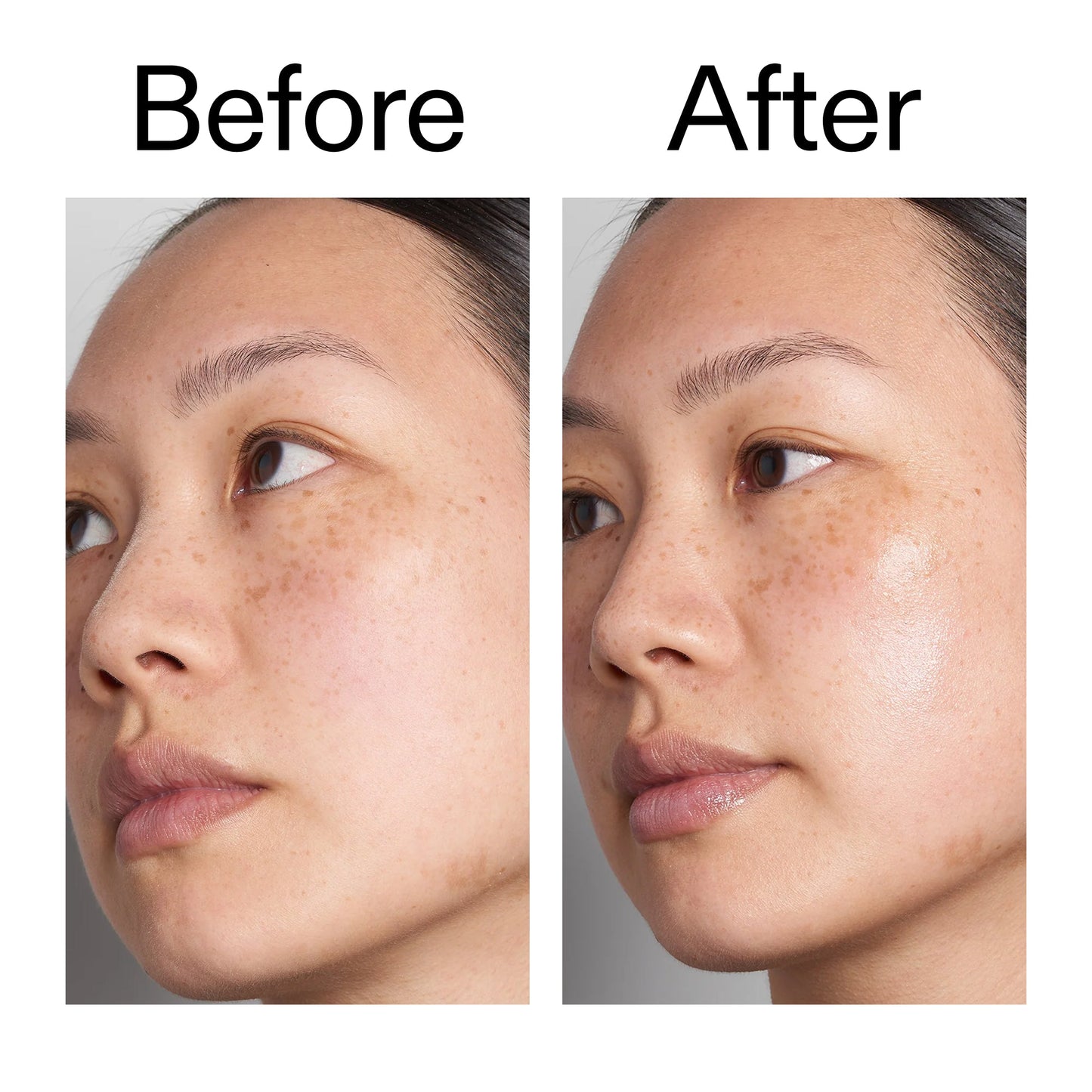 hyaluronic-acid-serum-30ml-d1 Hyaluronic_Acid_Before_After_2000x2000_d7983956-8aa2-4ea3-8255-c63e8d4f892e.jpg