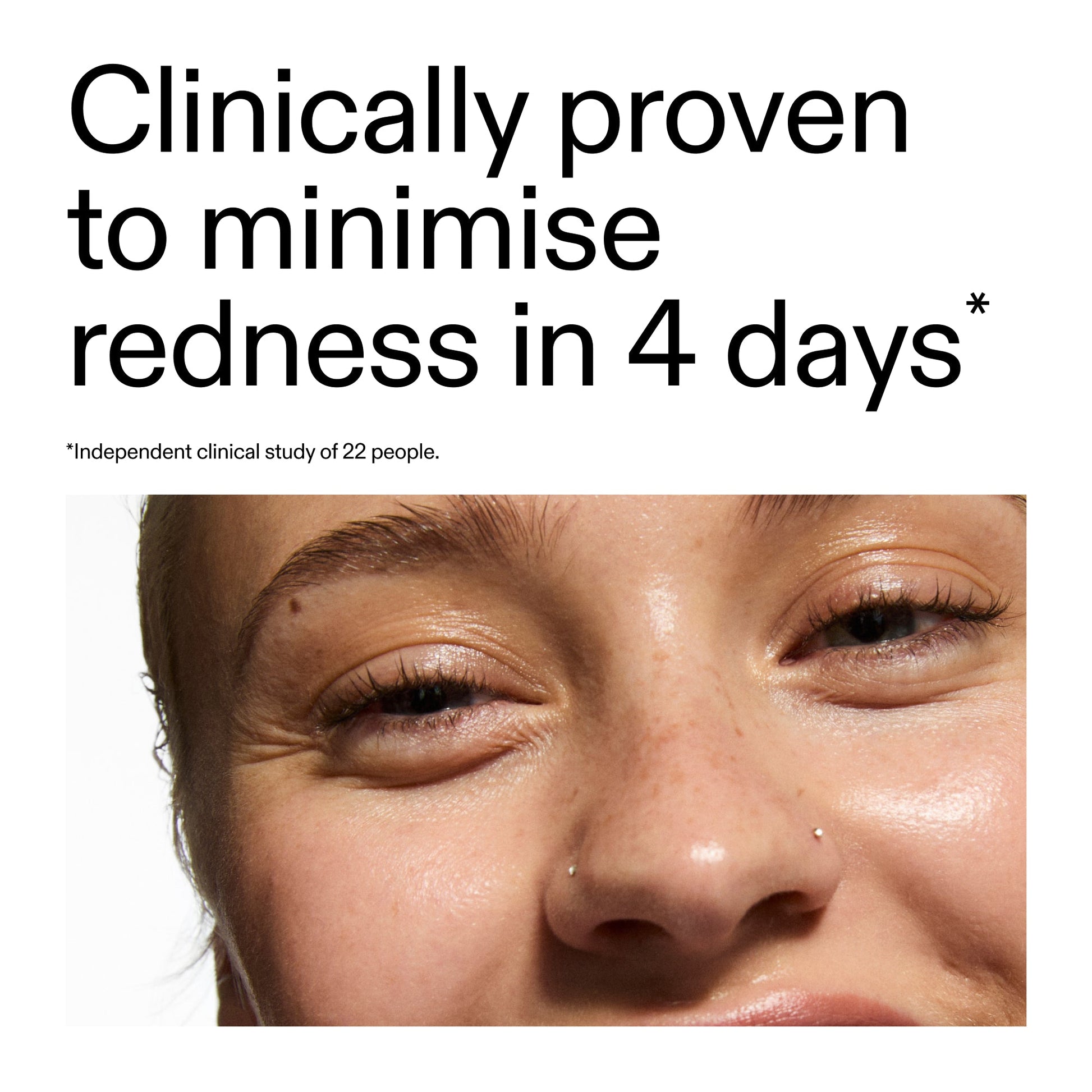 10-azelaic-acid-serum-for-redness-relief-a7 Oat_Cleansing_Balm_Claim_2000x2000_52a841dc-353c-4f2c-8646-3aadb604507d.jpg