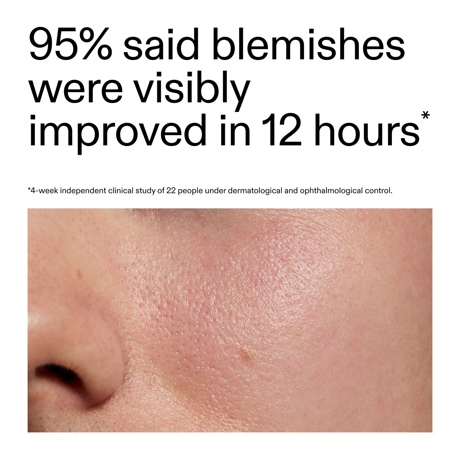 succinic-acid-acne-treatment-r6 Oat_Cleansing_Balm_Claim_2000x2000_ac6ce553-25db-41b2-a981-faae1ac4b8c0.jpg