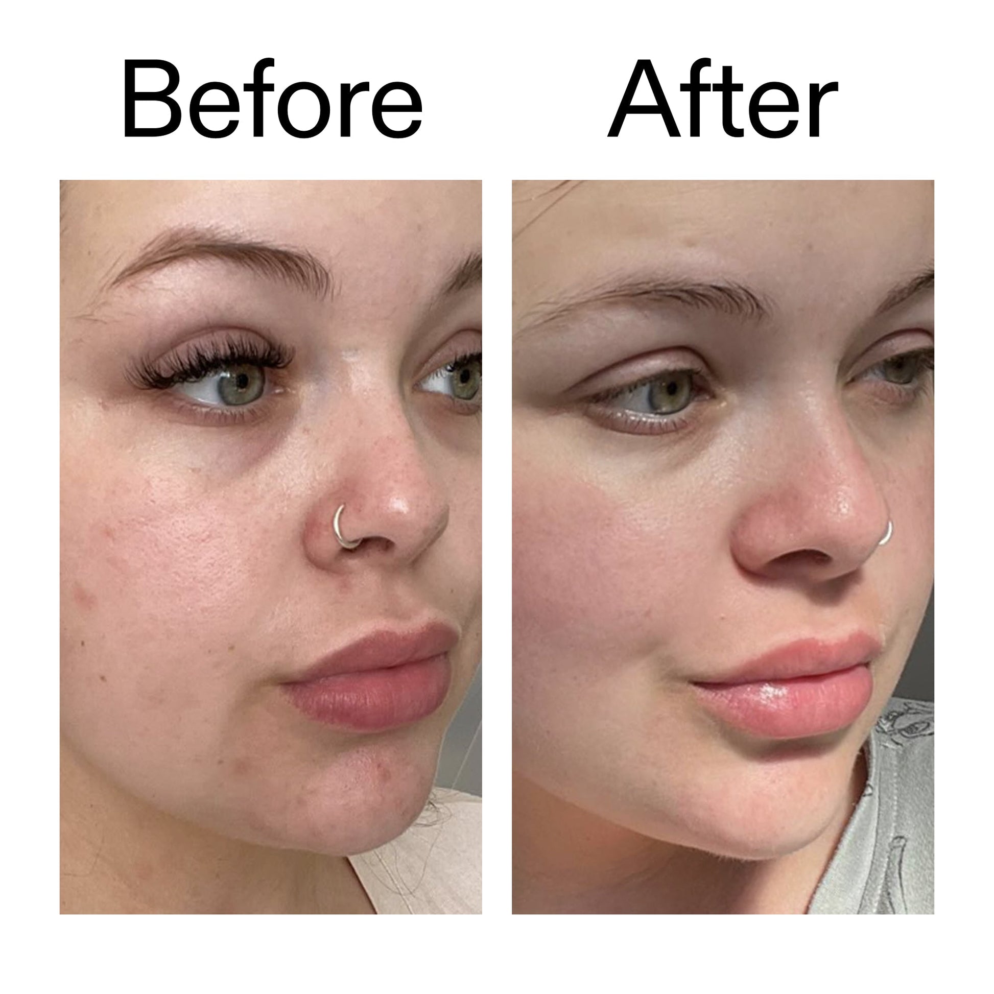 omega-water-cream-50ml-f6 Omega50_Before_After_2000x2000_46483ed8-3f9d-487f-9a0c-9df79830bd65.jpg