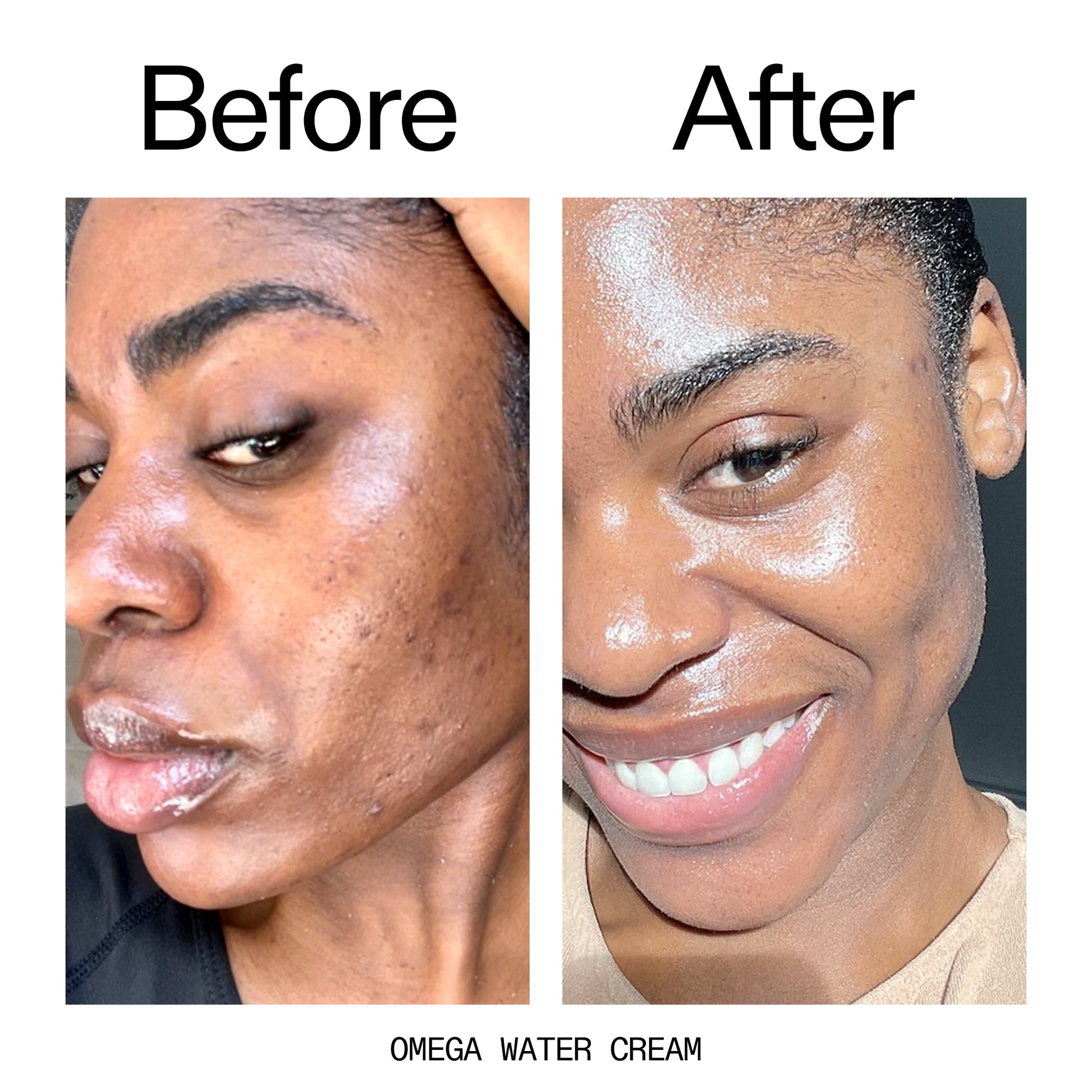 glowing-skin-set-b1 Omega_Water_Cream_Before_After_2000x2000_8e88278b-8c8d-48dc-ac77-4e98ebbd1b77.jpg