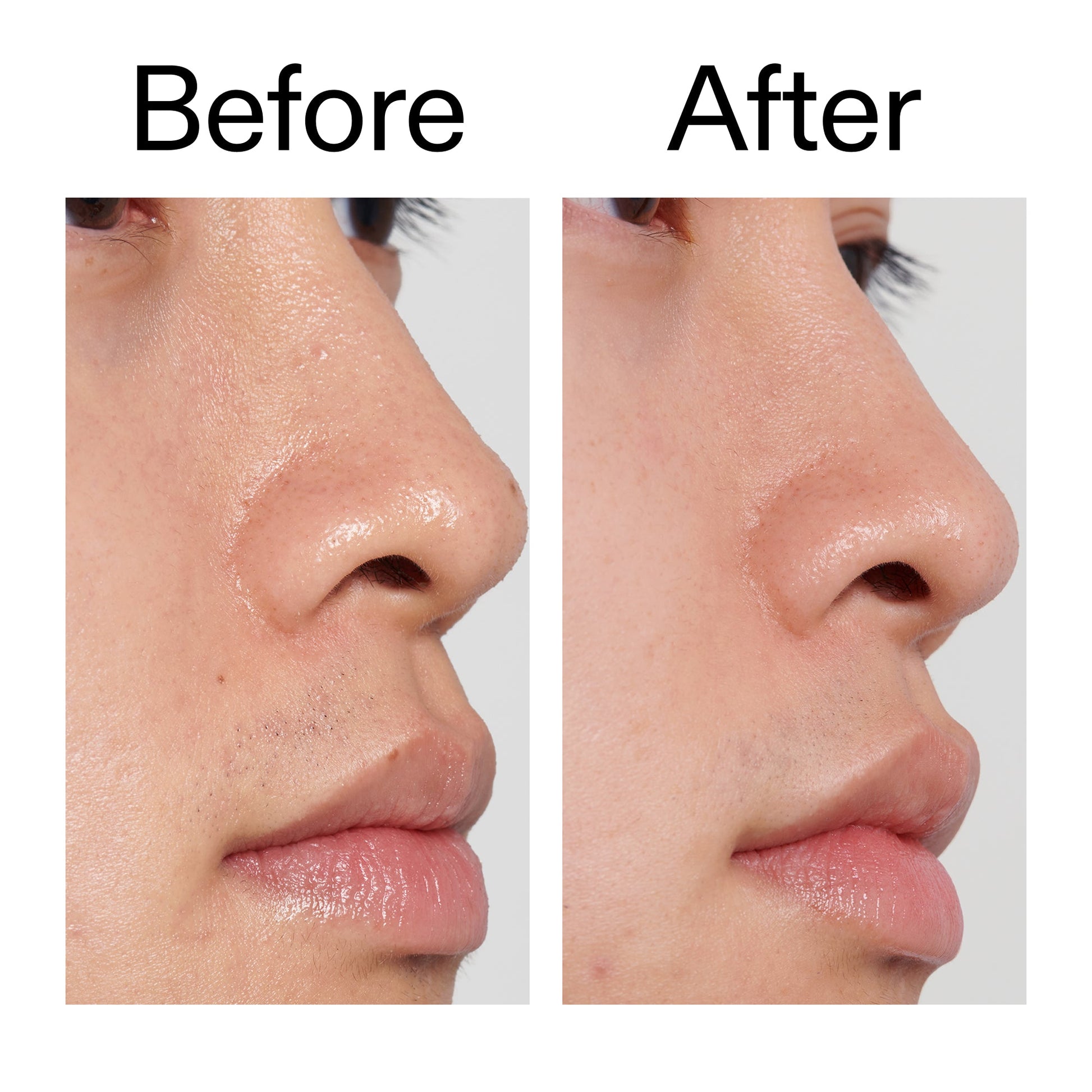 pha-toner-c4 PHA_Toner_Before_After_2000x2000_e3c10172-0150-4342-8b95-57417eaff50d.jpg