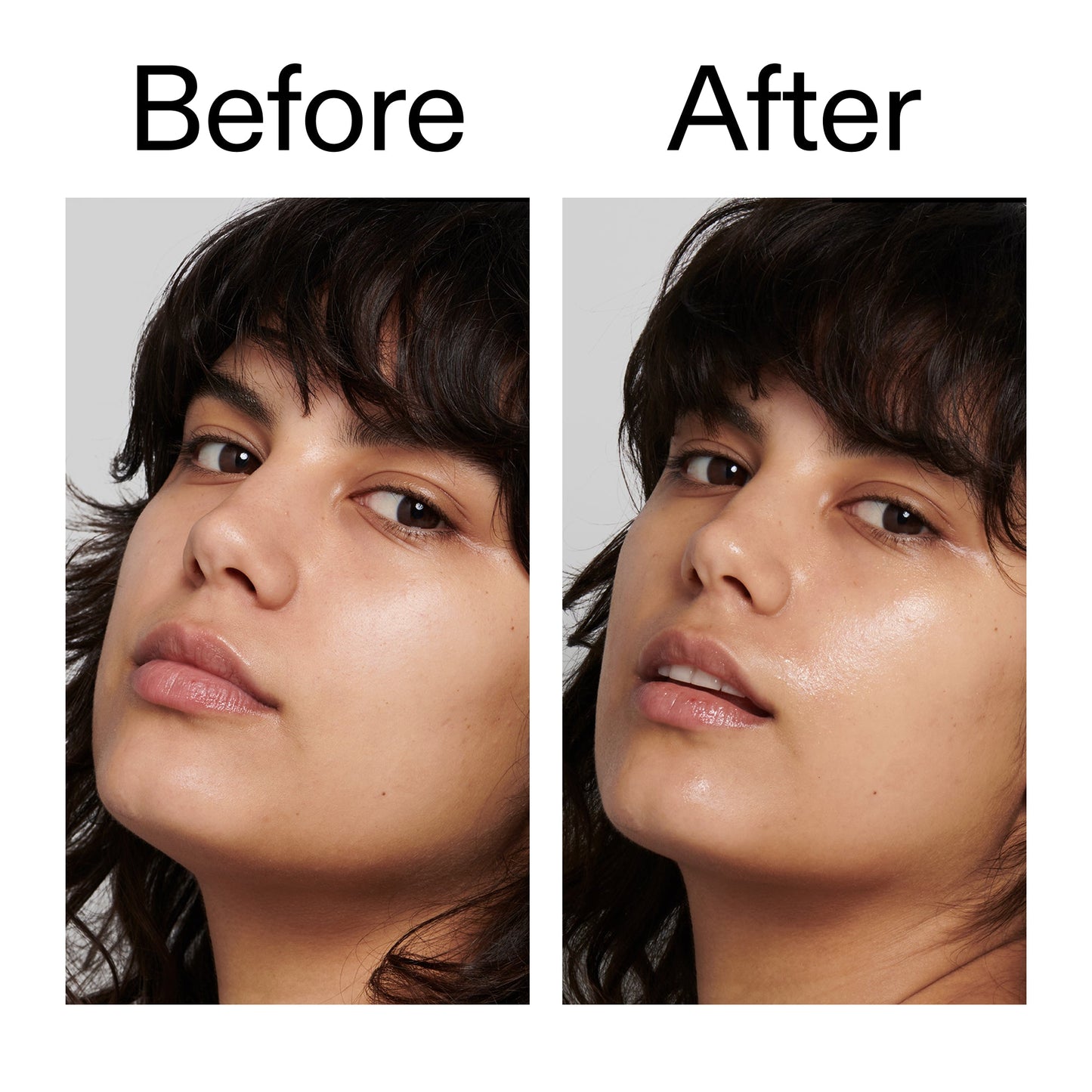 polyglutamic-acid-serum-g8 Polyglutamic_Acid_Serum_Before_After_2000x2000_dc0e1f71-d72b-4358-9c3a-ae43ead715d6.jpg