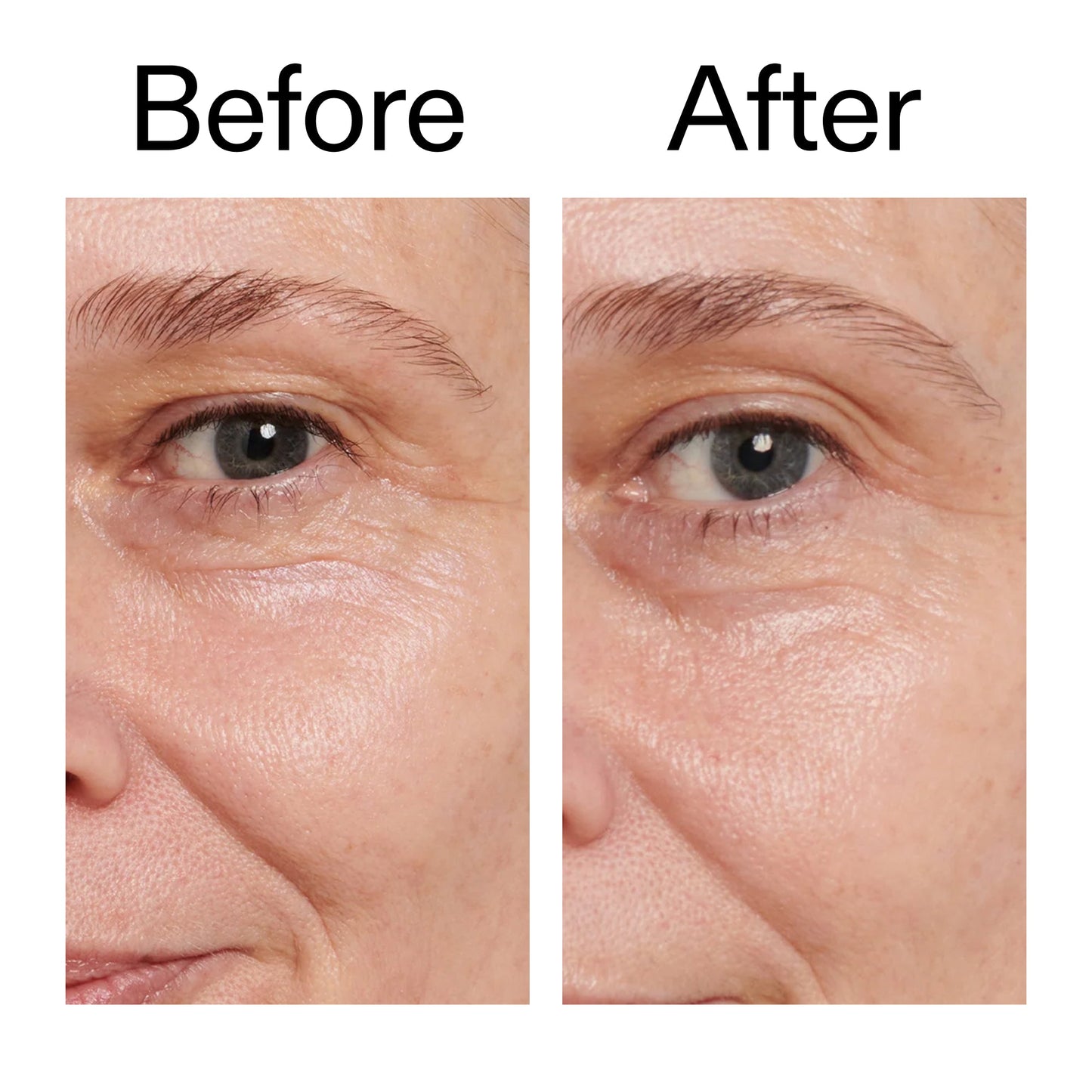 retinol-eye-cream-w8 Retinol_Eye_Cream_Before_After_2000x2000_ac03a80c-109e-4572-a95a-91dc109b4d27.jpg