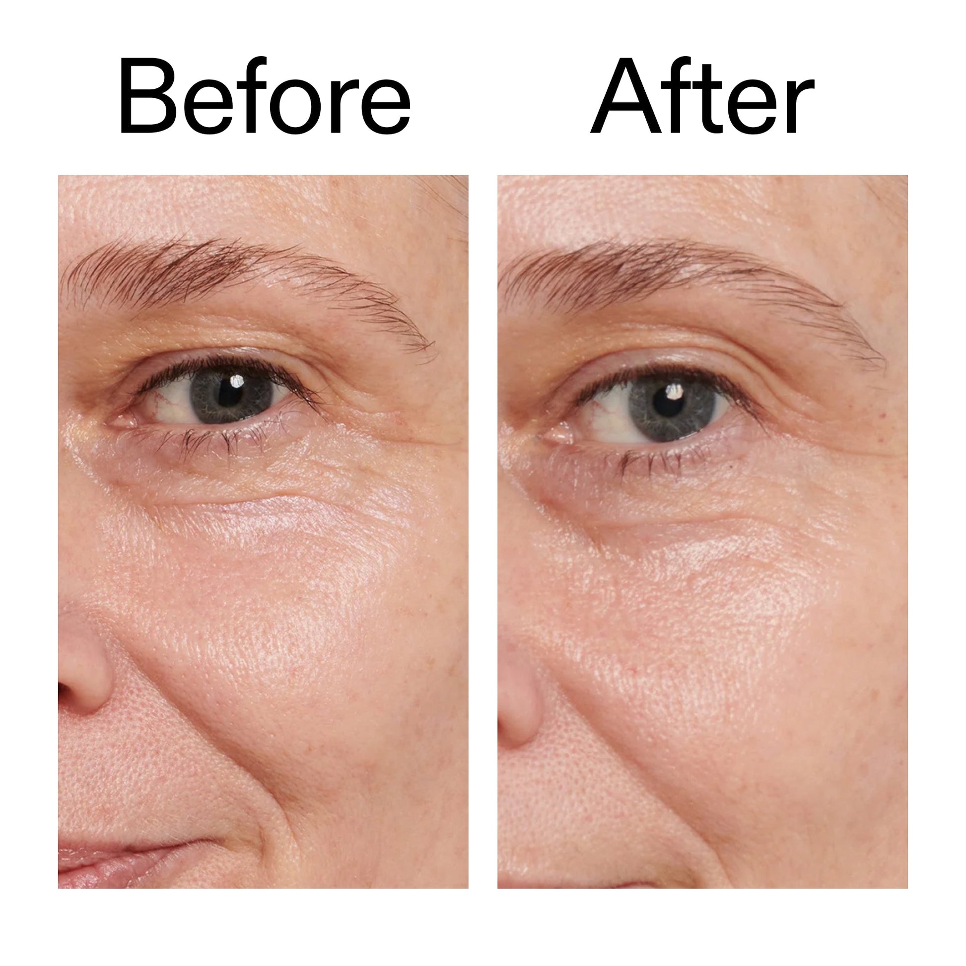 retinol-eye-cream-w8 Retinol_Eye_Cream_Before_After_2000x2000_ac03a80c-109e-4572-a95a-91dc109b4d27.jpg