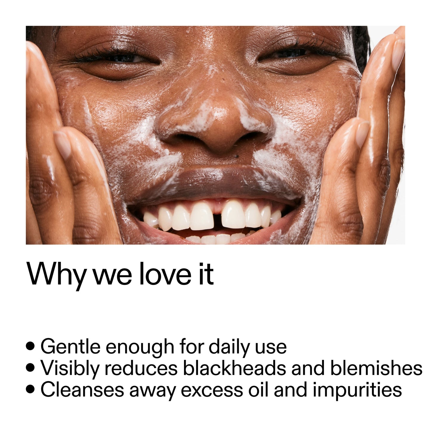 salicylic-acid-cleanser-150ml-u8 Salicylic_Acid_Cleanser_-_300mlWhy_we_love_it_2000x2000_87dc92a9-2559-4309-98cd-4e570f1be735.jpg