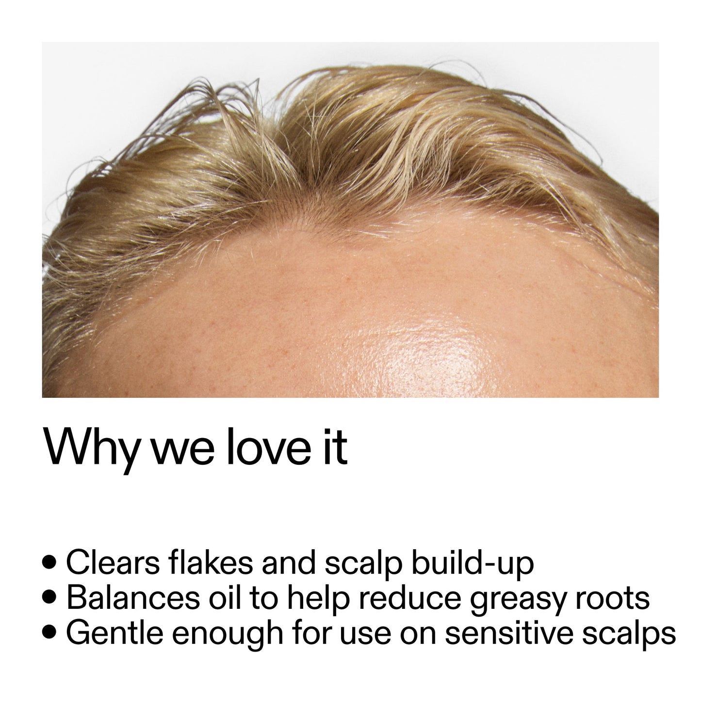 salicylic-acid-exfoliating-scalp-treatment-s7 Salicylic_Acid_Exfoliating_Scalp_Treatment_Why_we_love_it_2000x2000_44b6bd6d-9ec4-4b23-9dc4-bc3fd6f28e14.jpg