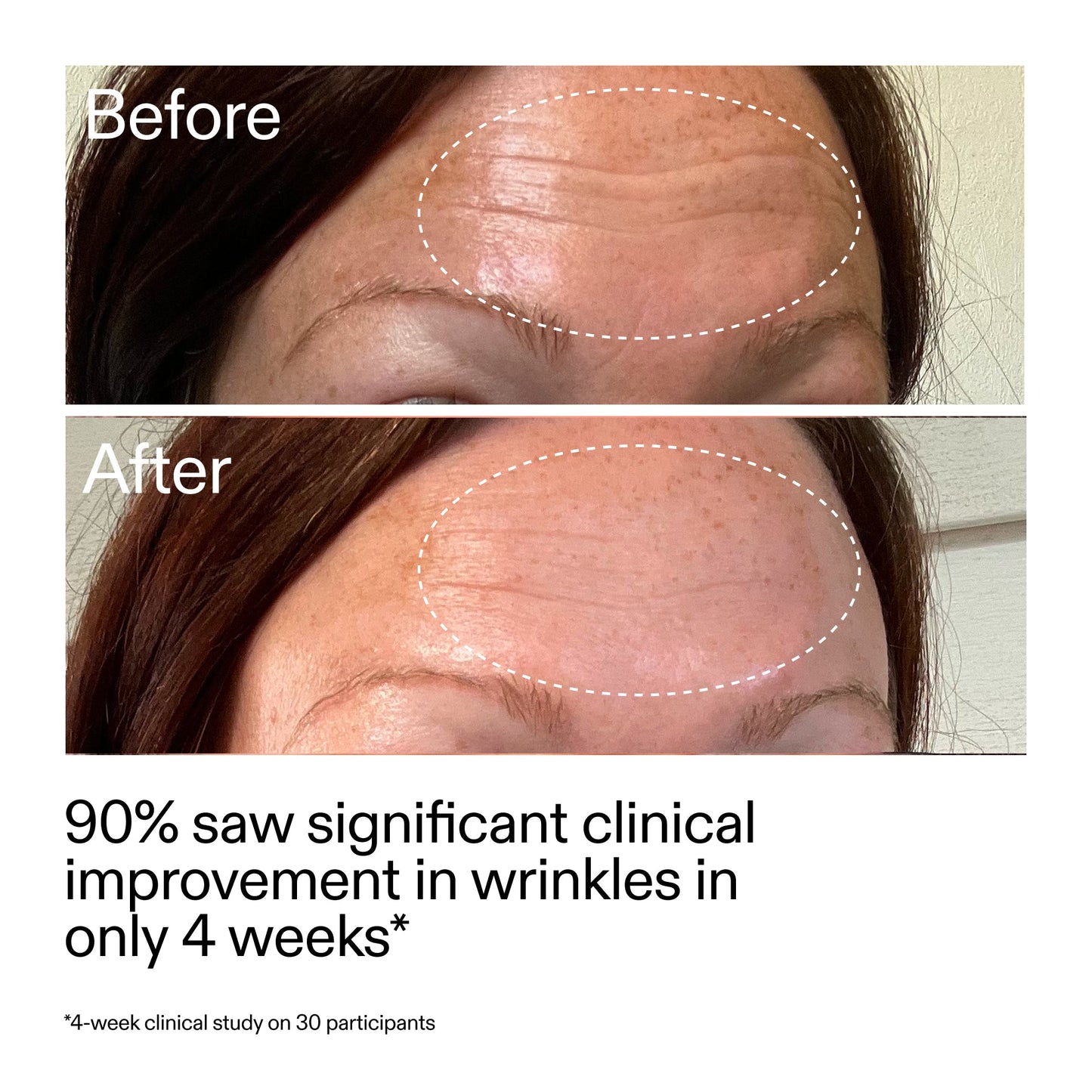 starter-retinol-serum-c3 StarterRetinol_BeforeAfter_Claim1_2000x2000_a09b50b6-4688-4527-abae-21bd142b89b7.jpg