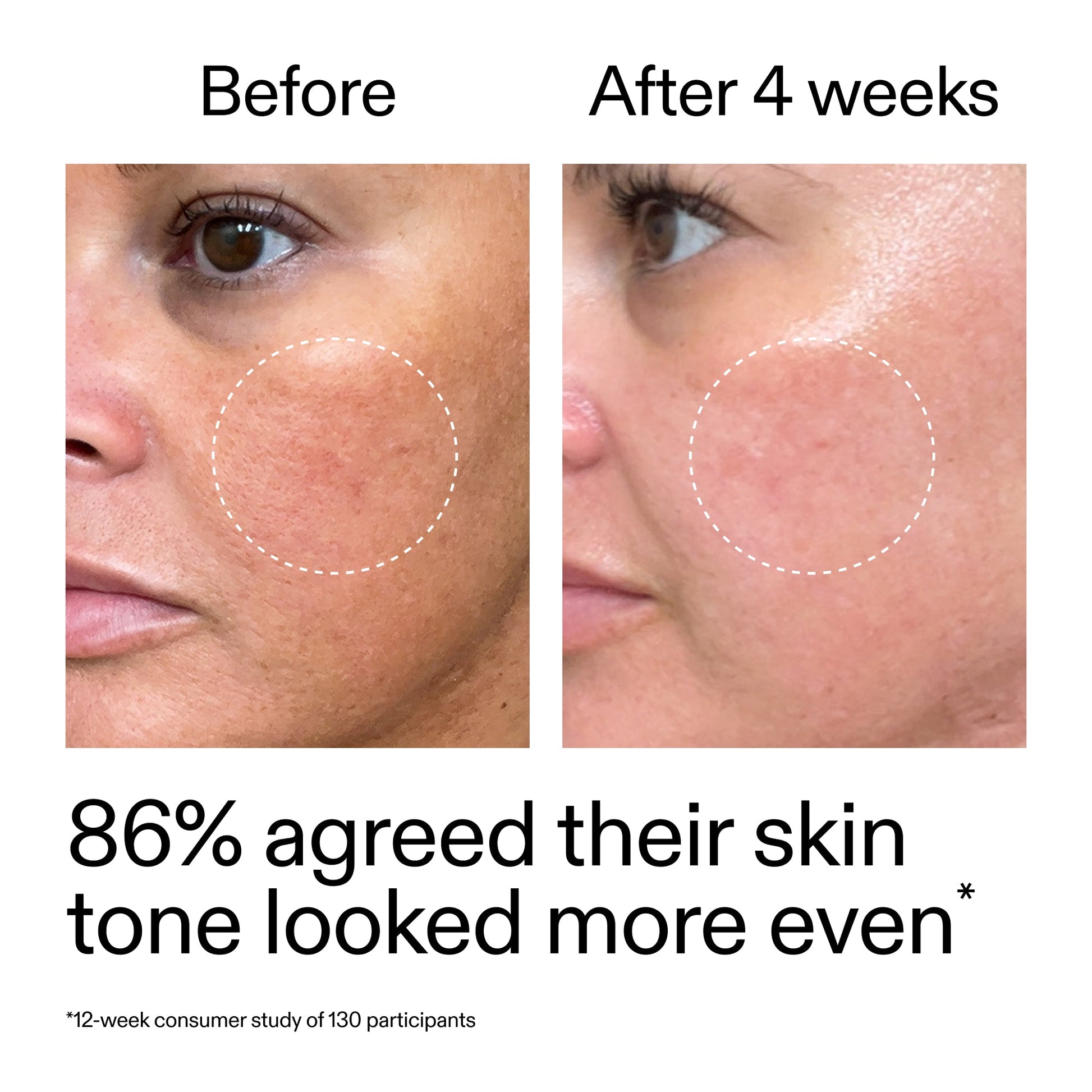 starter-retinol-serum-duo-h3 StarterRetinol_BeforeAfter_Claim2_2000x2000_fc5bb8ac-8588-478f-98d5-28af6651601a.jpg