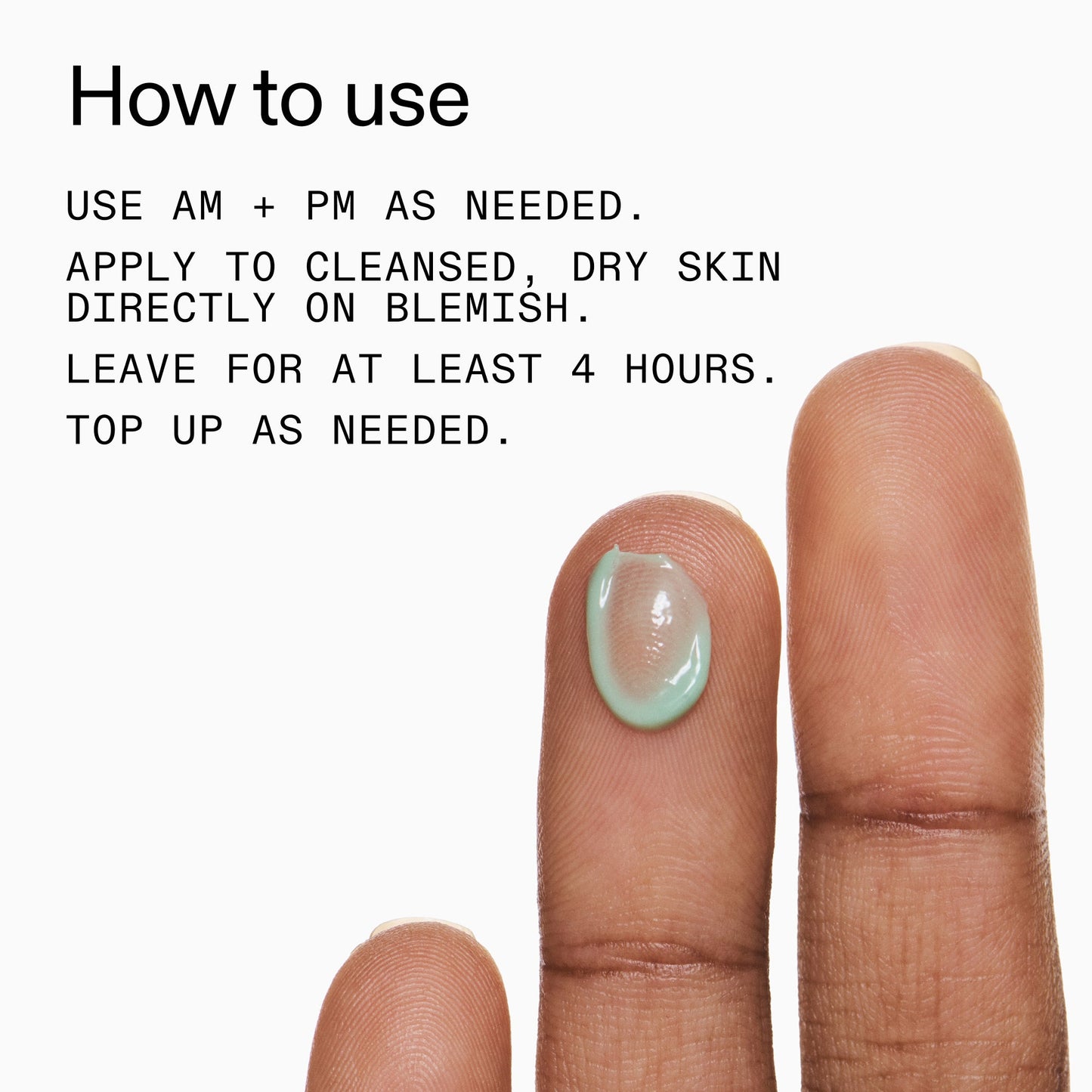 succinic-acid-acne-treatment-r6 Succinic_Acid_Treatment_How_to_Use_2000x2000_d57137d5-d7f1-427c-9a46-5fc00c19c542.jpg