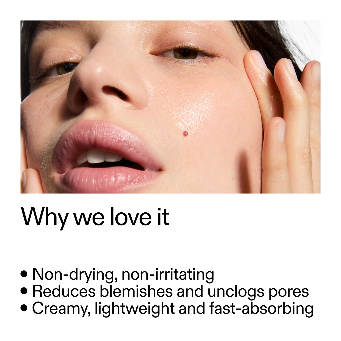 succinic-acid-acne-treatment-r6 Succinic_Acid_Treatment_Why_we_love_it_2000x2000_e90dd42a-cfe9-48b5-a2c7-d5eda787a6a8.jpg
