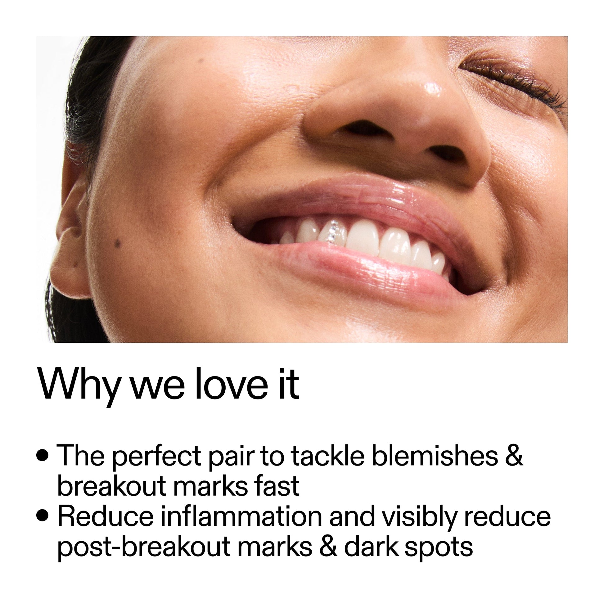 targeted-blemish-duo-o7 Targeted_Blemish_Duo_Why_we_love_it_2000x2000_ff00be46-438b-485f-b5c3-91e60bbb6919.jpg