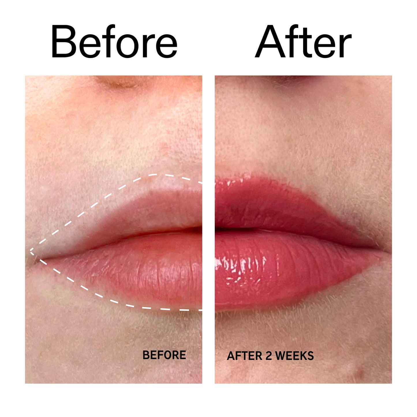 tripeptide-plumping-berry-lip-balm-f1 Tripeptide_Plumping_Lip_Balm_-_Berry_Before_After_2000x2000_9474bbd8-43ca-4b0e-b0e7-dfab70b91927.jpg
