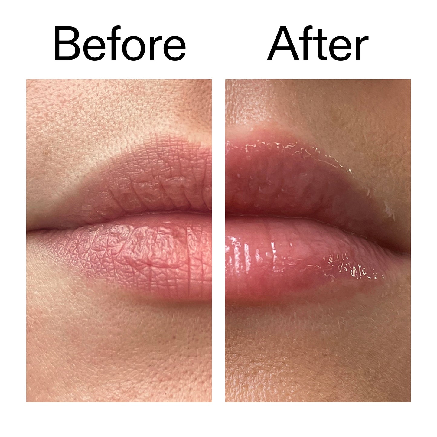 lip-plumping-duo-g6 Tripeptide_Plumping_Lip_Balm_Before_After_2000x2000_b4a5ee04-d2ac-4857-8f01-17209acc4bf3.jpg