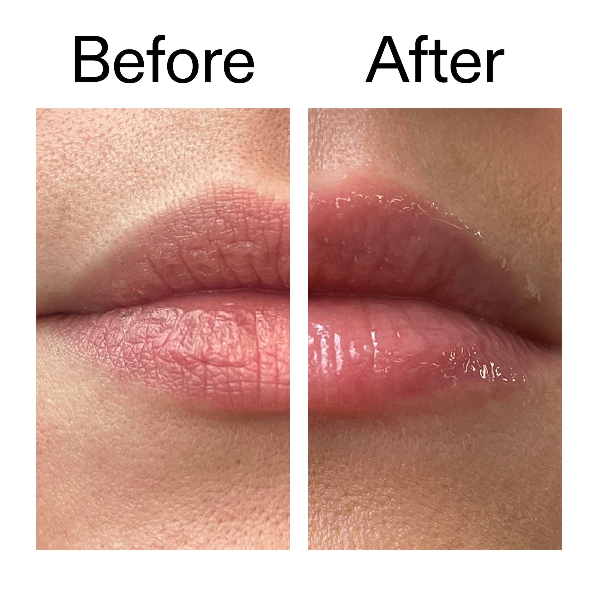 lip-plumping-duo-g6 Tripeptide_Plumping_Lip_Balm_Before_After_2000x2000_b4a5ee04-d2ac-4857-8f01-17209acc4bf3.jpg