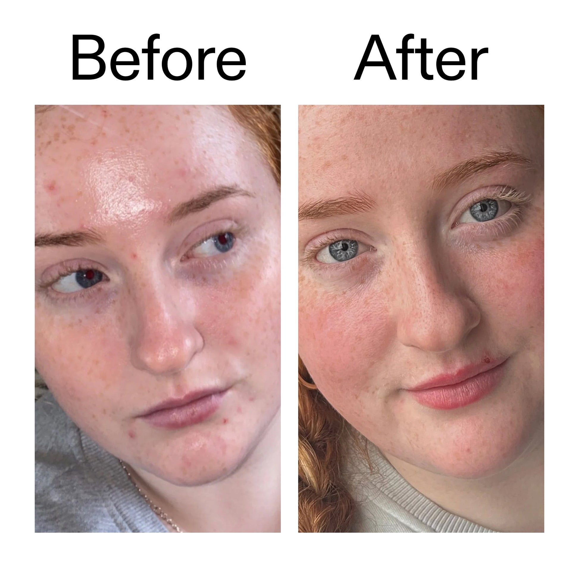 vitamin-b-c-and-e-moisturizer-k4 Vitamin_B_C_and_E_Moisturizer_Before_After_2000x2000_b0781a76-5ad2-4be9-95b8-ef92b356833c.jpg
